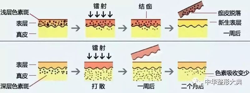 圖文圖片
