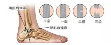 圖文圖片
