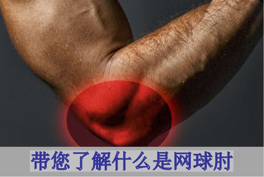 圖文圖片