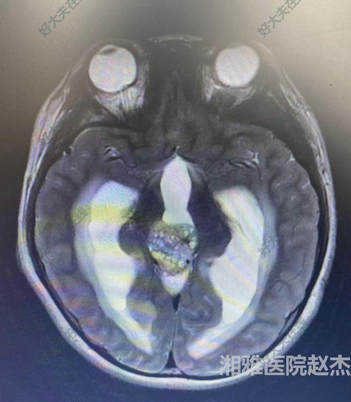 圖文圖片