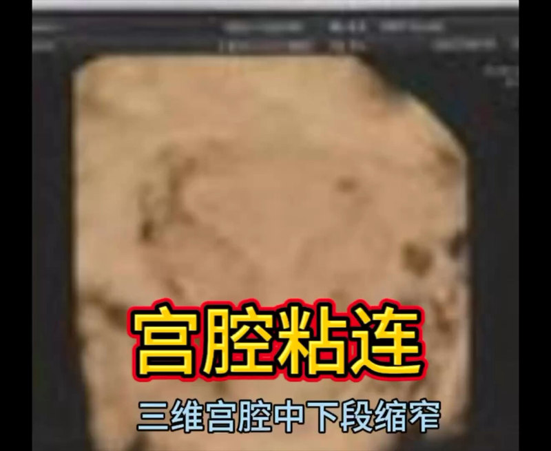視頻封面