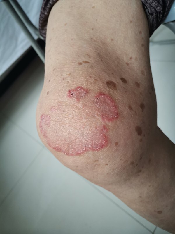 圖文圖片