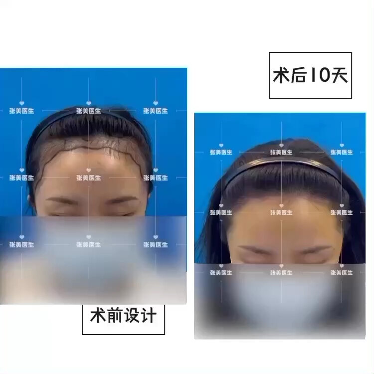 視頻封面
