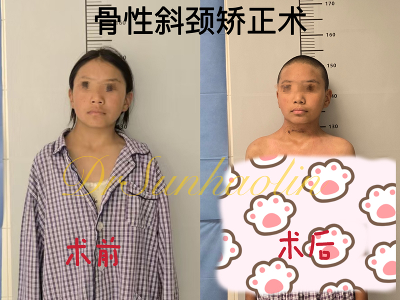 圖文圖片