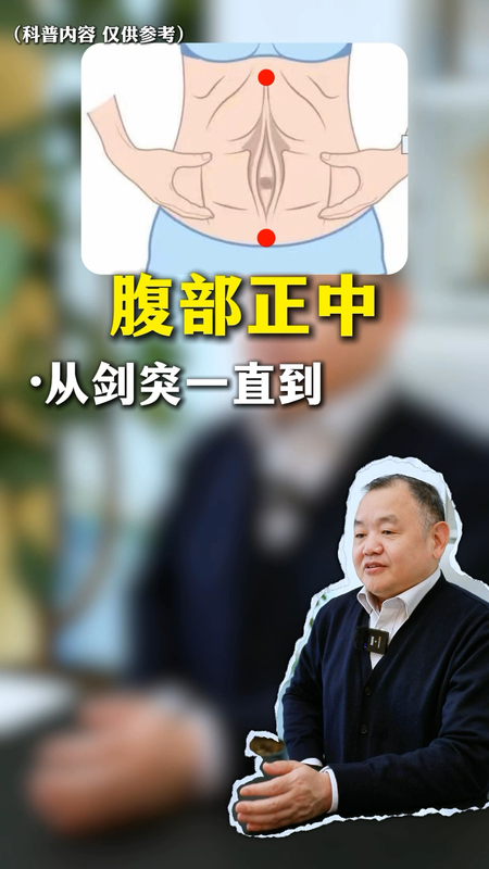 什么是腹直肌分离？