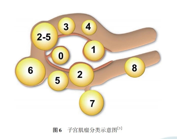 圖文圖片