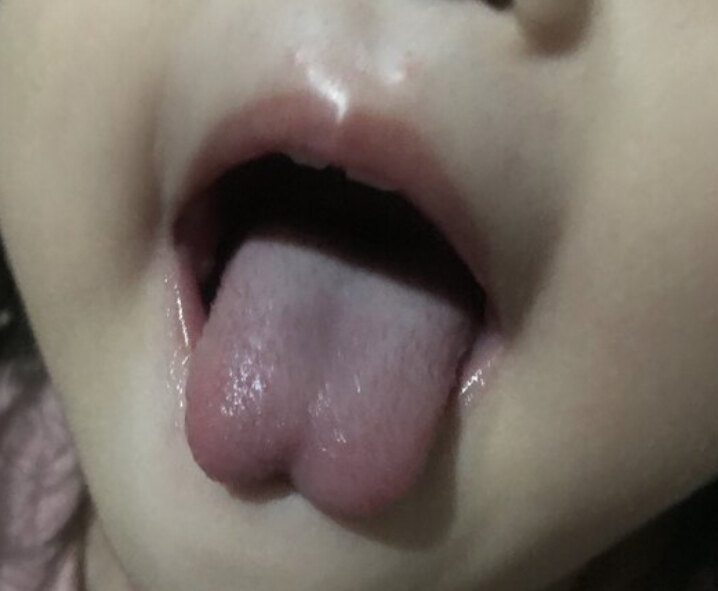 圖文圖片