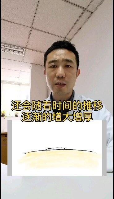 老年斑会不会恶变？