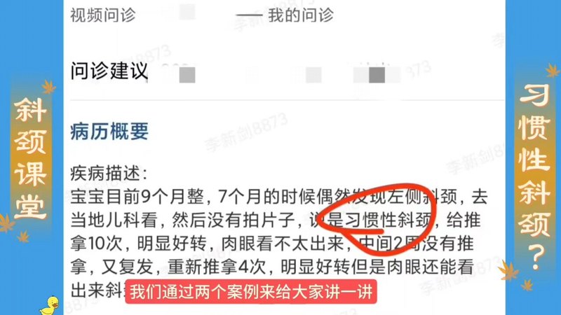 没有肿块没有粗筋是习惯性斜颈吗？