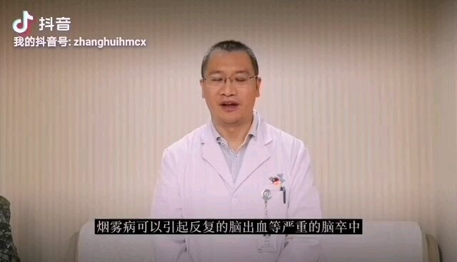 烟雾病一定要早治疗