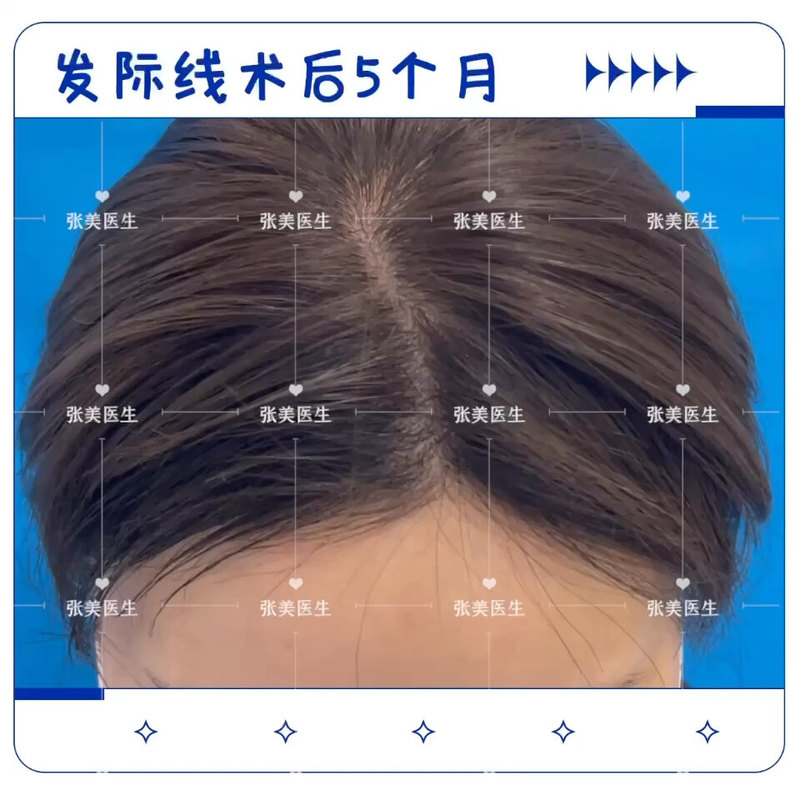 視頻封面