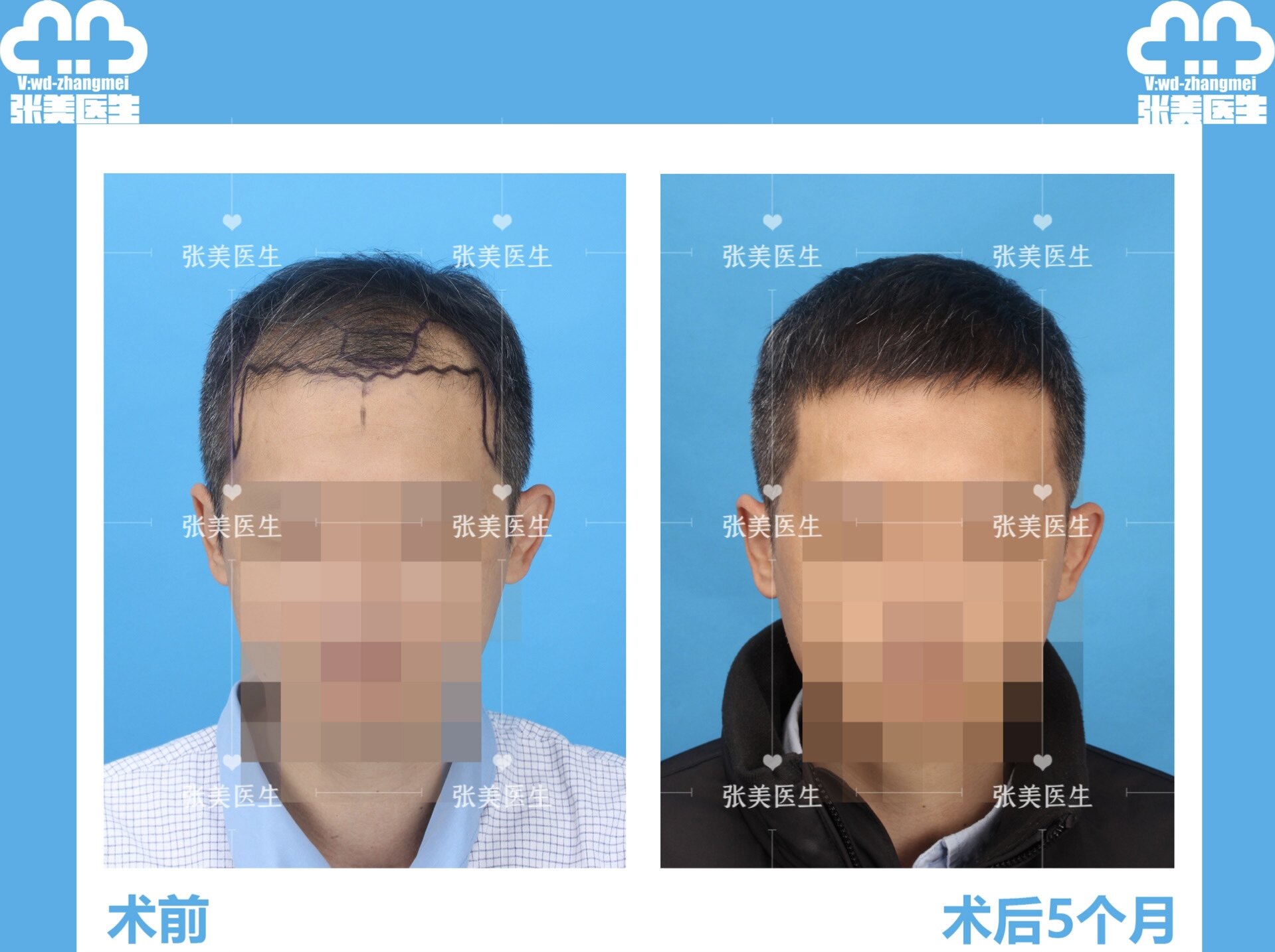 圖文圖片