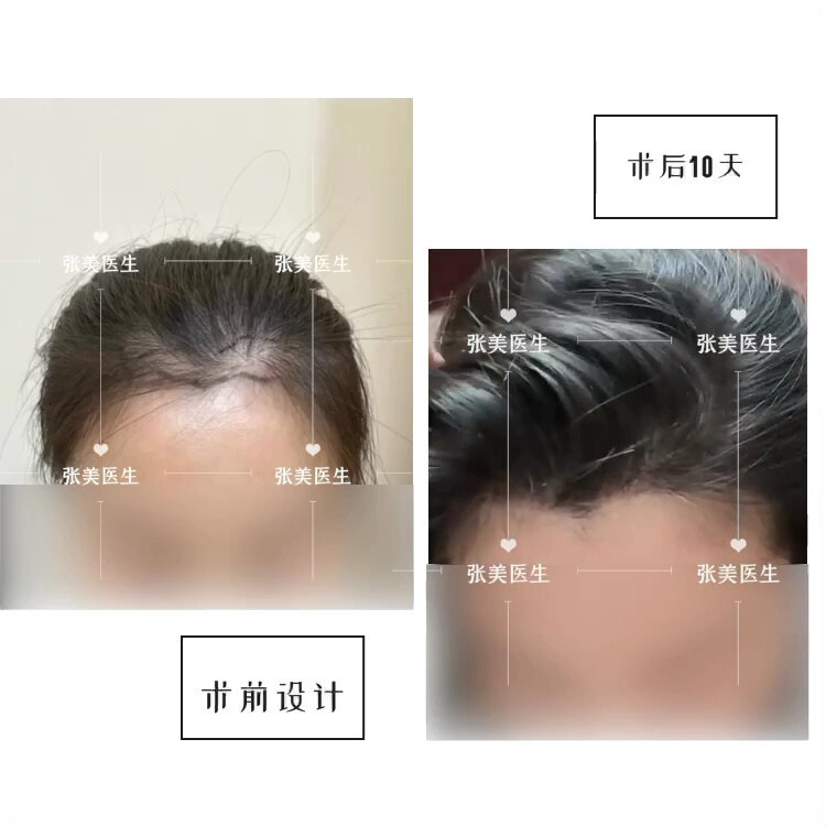 視頻封面