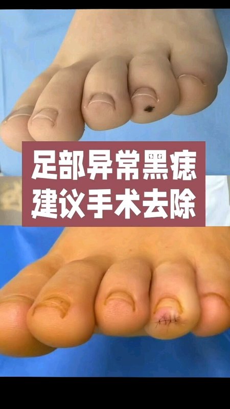 視頻封面