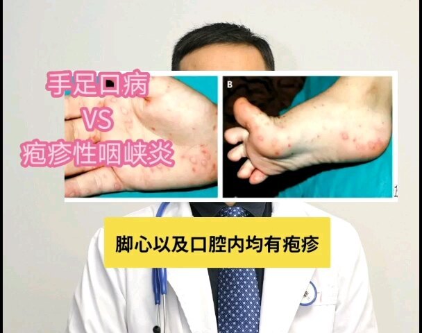視頻封面