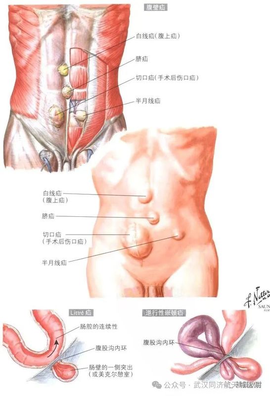 圖文圖片