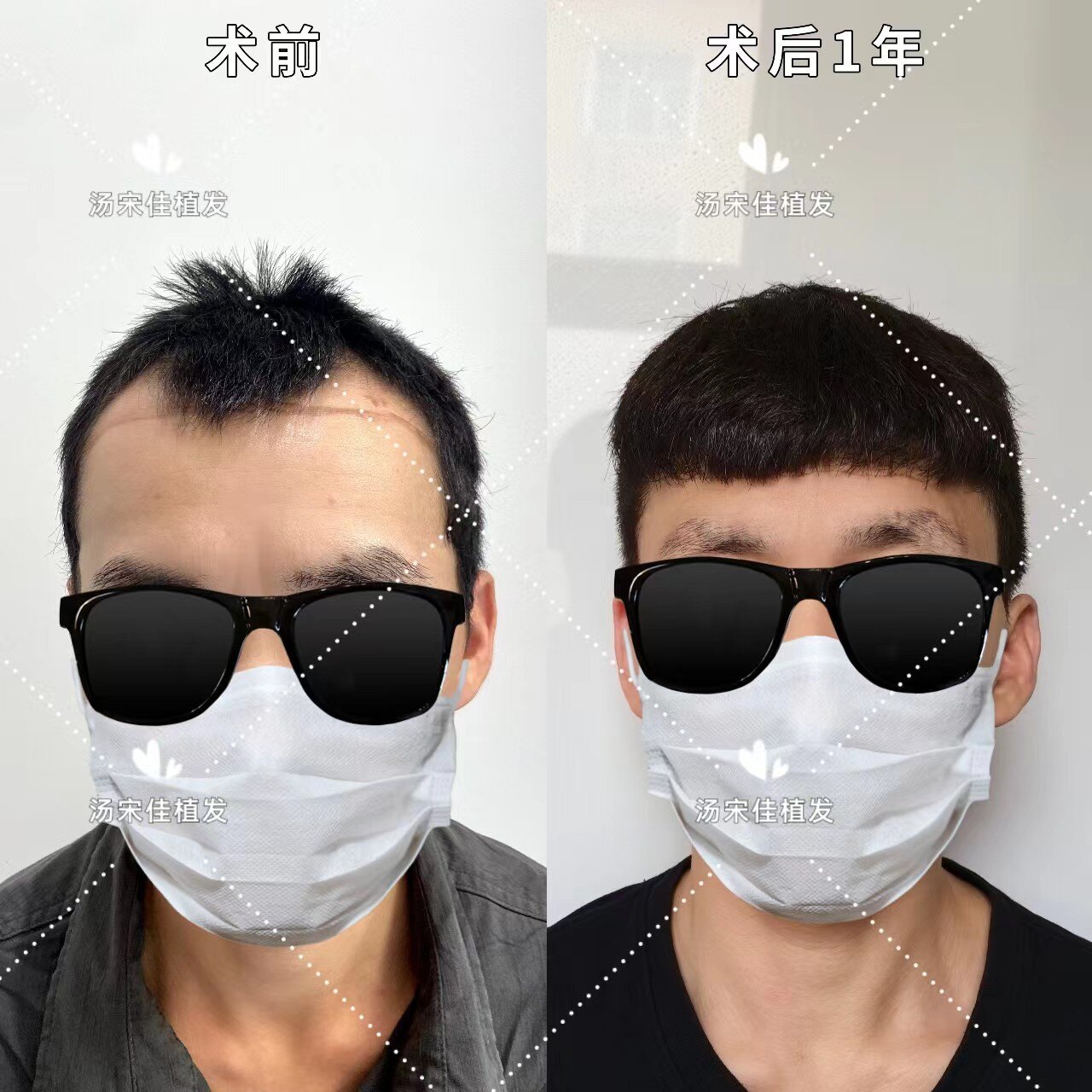 圖文圖片