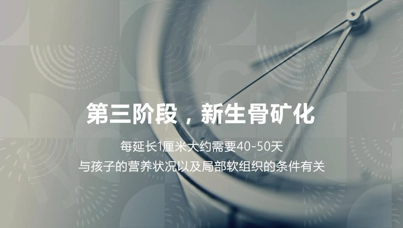 骨延长到底是怎么一回事（4）