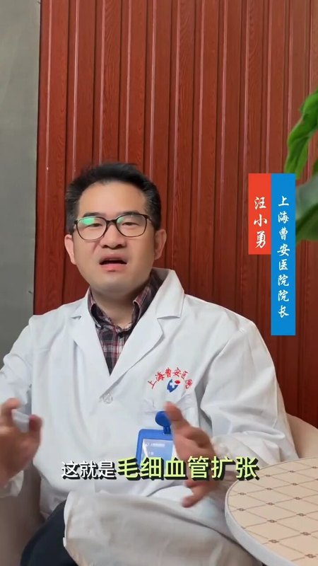 很多人疑惑，毛细血管扩张会发展成静脉曲张吗？我来为你解答