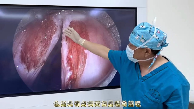 視頻封面