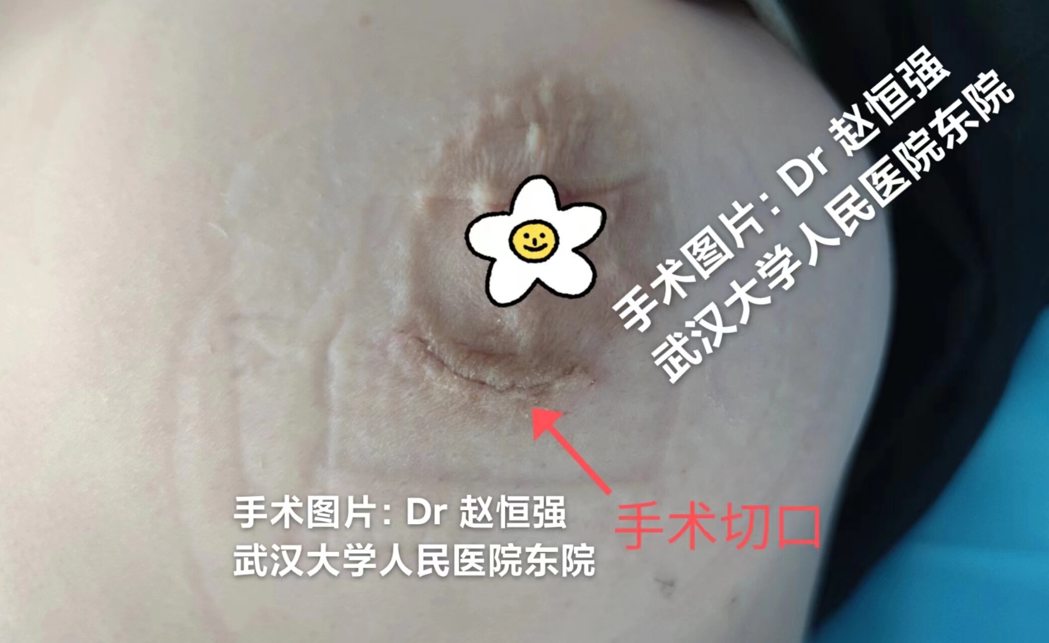 圖文圖片