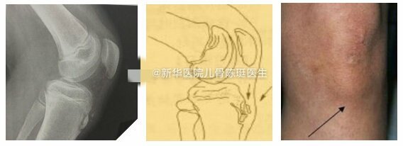 图文图片