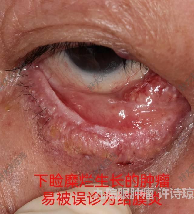 圖文圖片