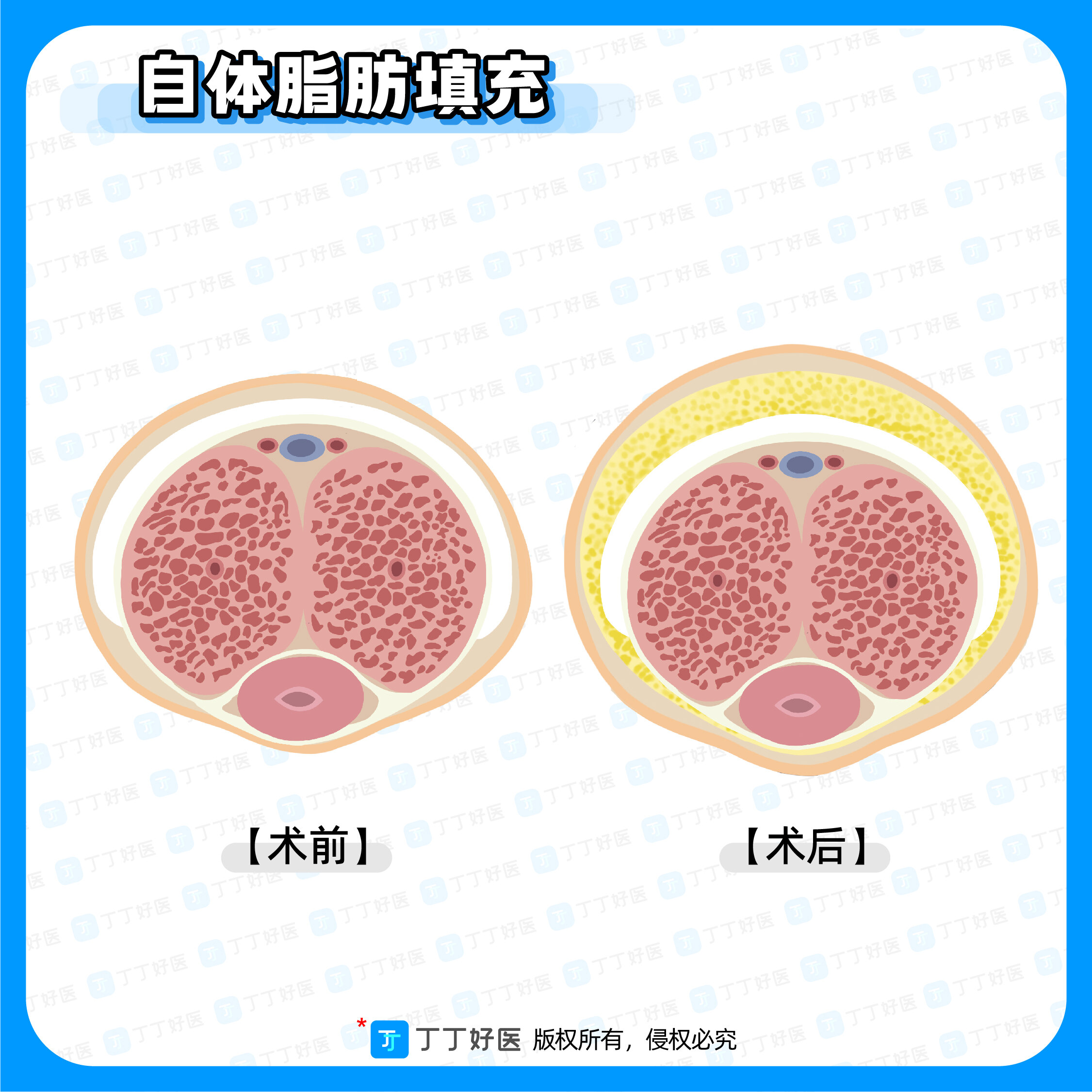 圖文圖片