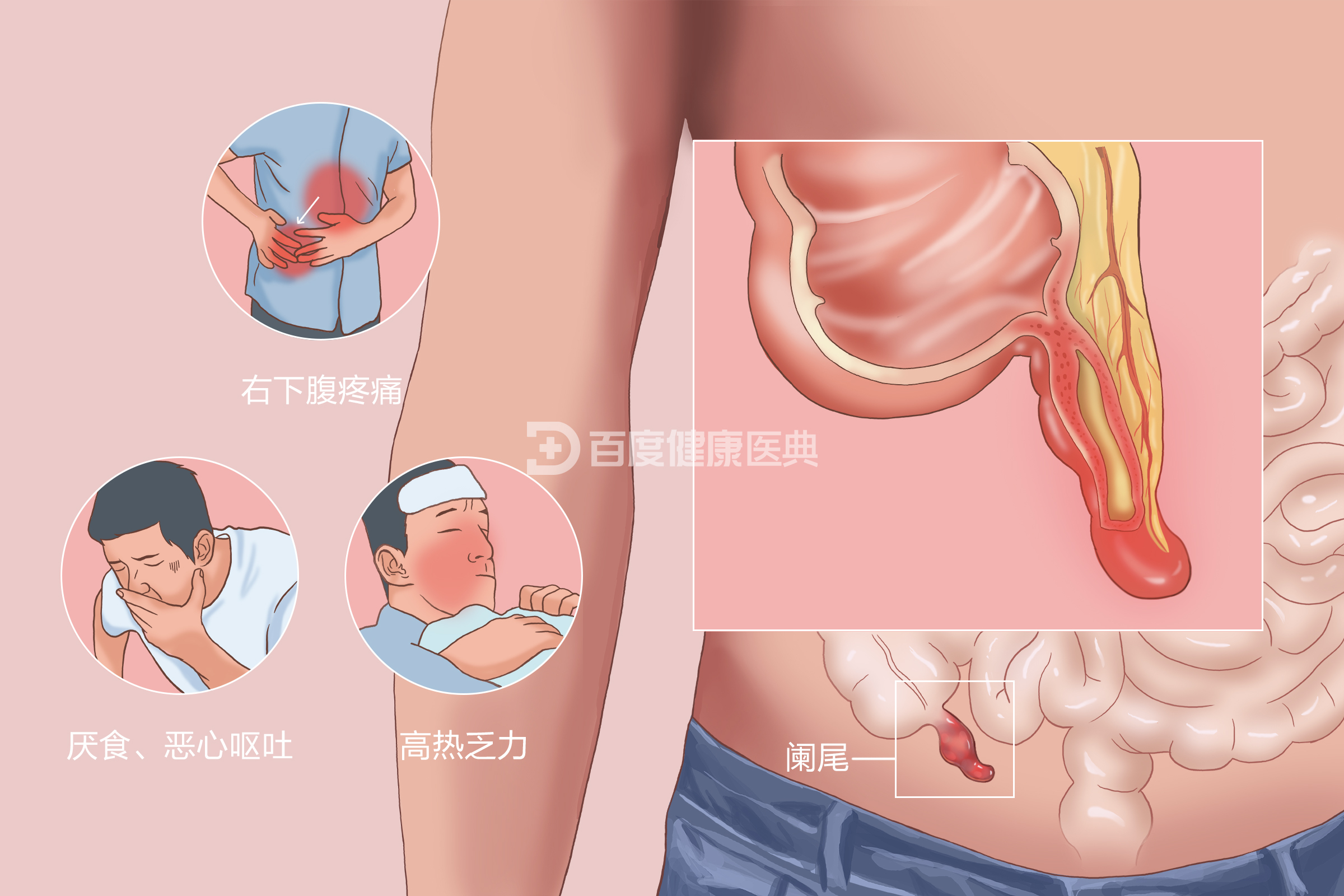 圖文圖片