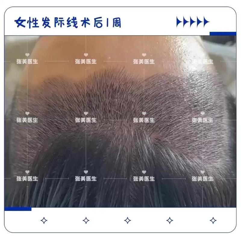 視頻封面