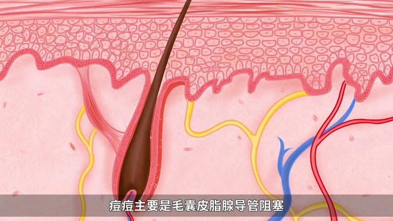 視頻封面