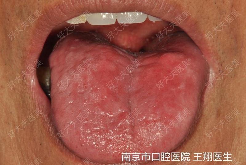 圖文圖片