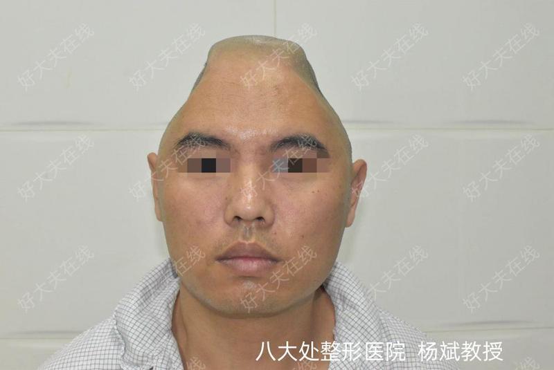 圖文圖片