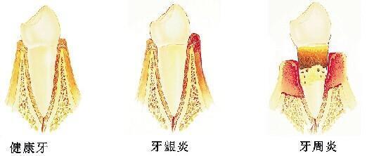 圖文圖片