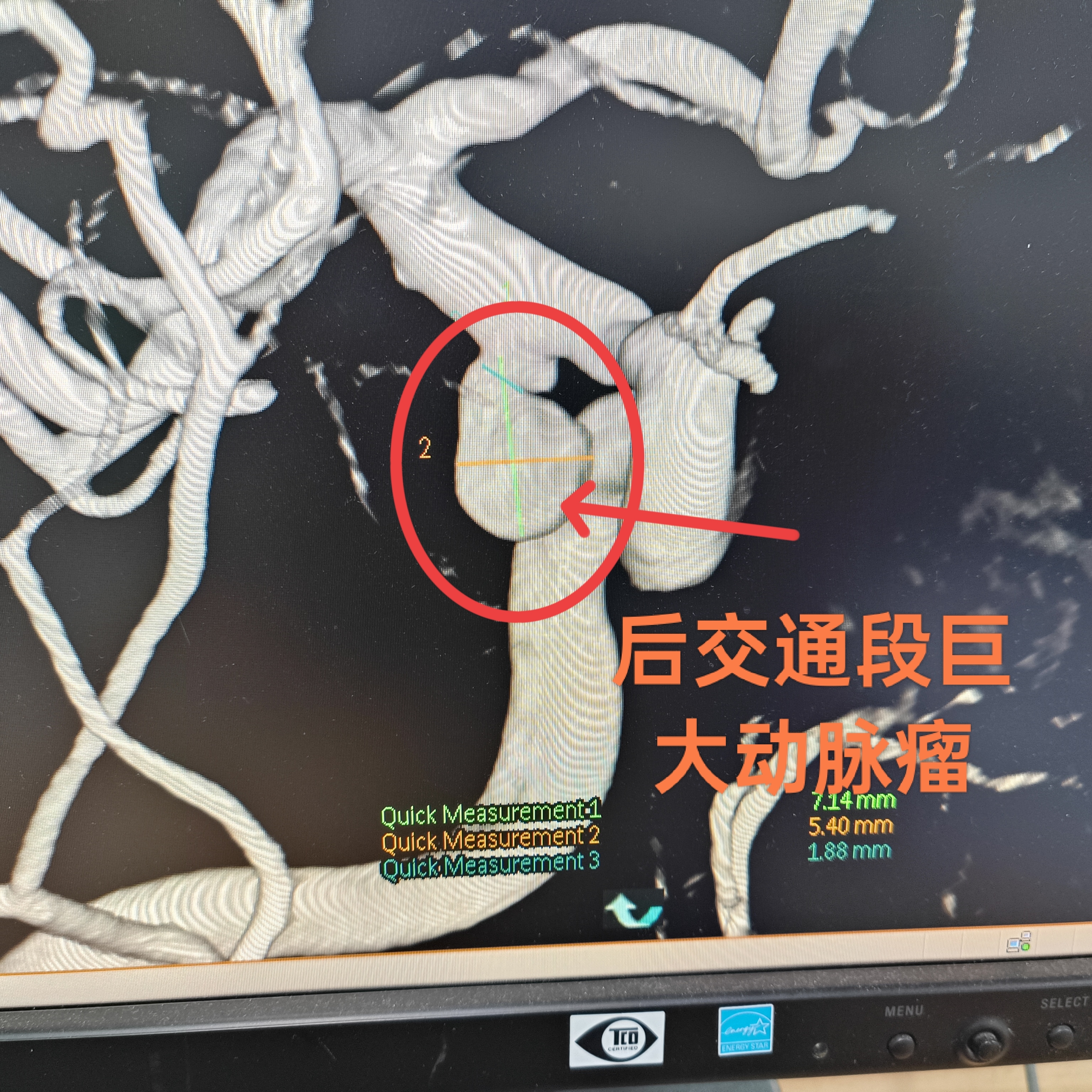 圖文圖片