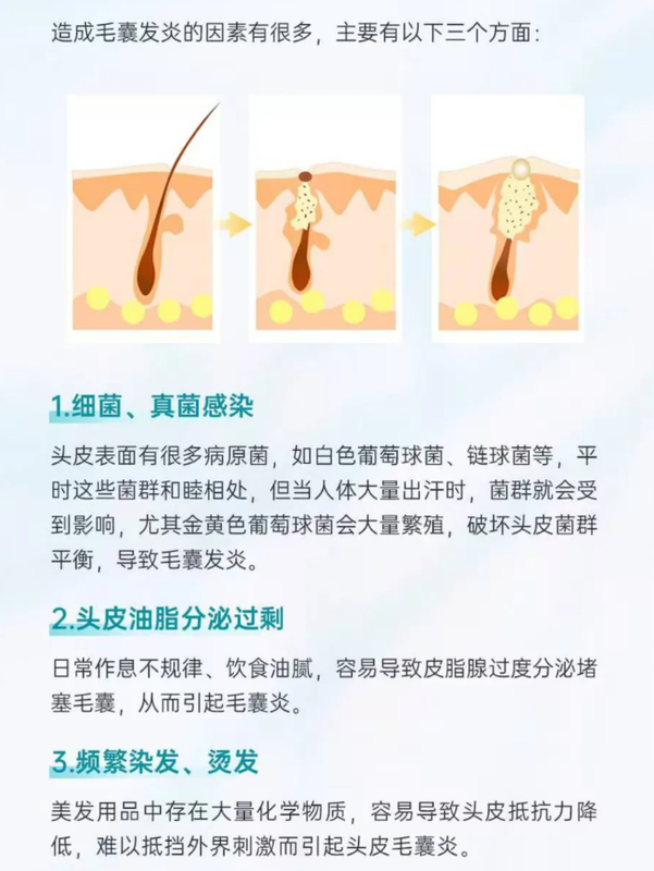 圖文圖片