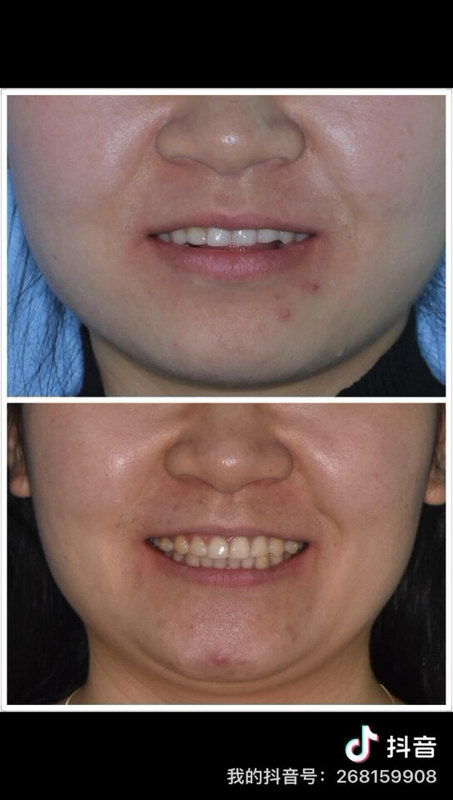 包含北京口腔医院先生医生问诊黄牛挂号方便快捷的词条