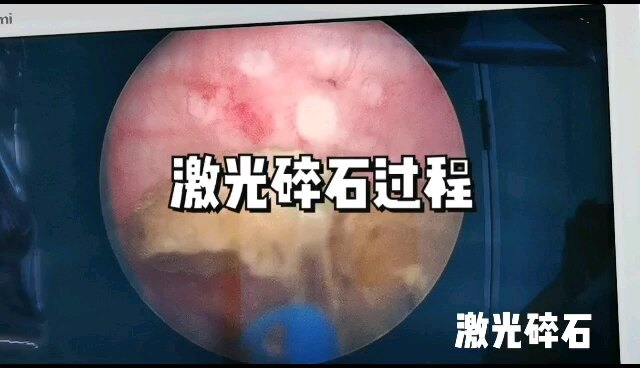 視頻封面