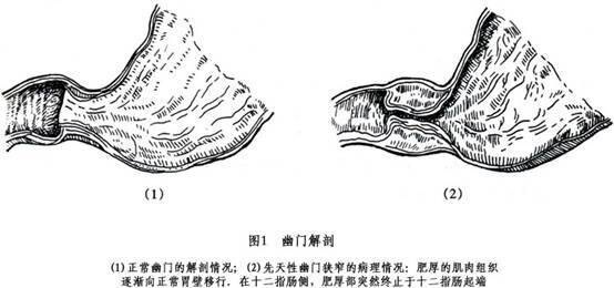 圖文圖片
