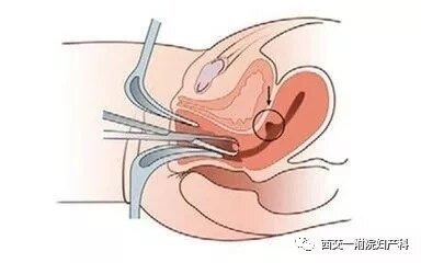 圖文圖片