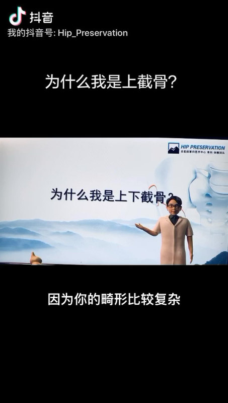 上下截骨手术好大呀，我只做上截骨可以不？