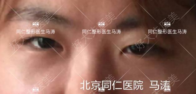 圖文圖片