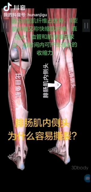网球腿形成原理