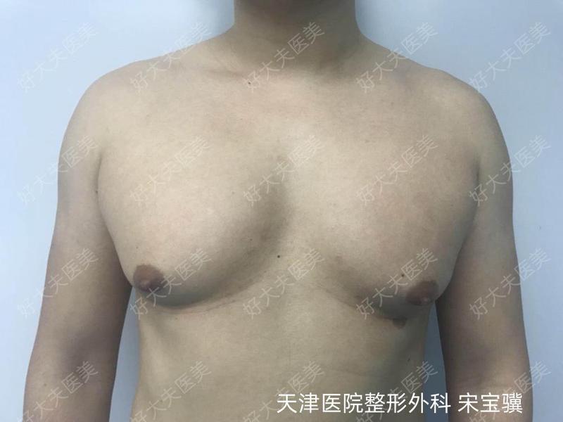 圖文圖片